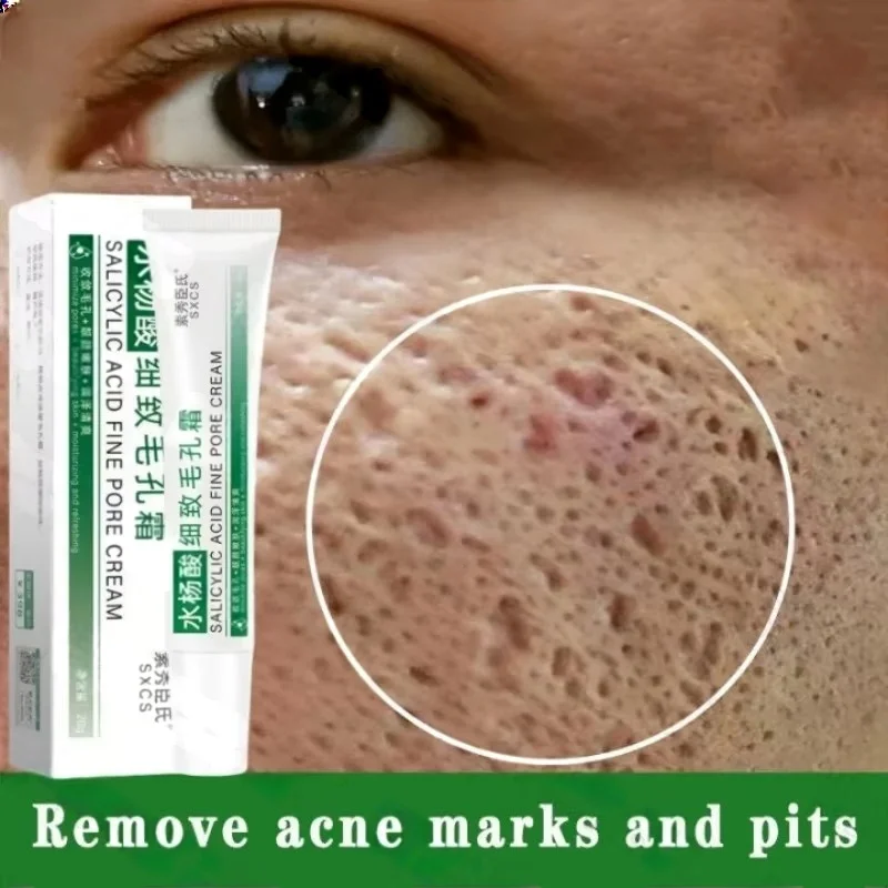 Korean Skincare Routine - 살리실산 모공 클리어링 크림 모공 축소