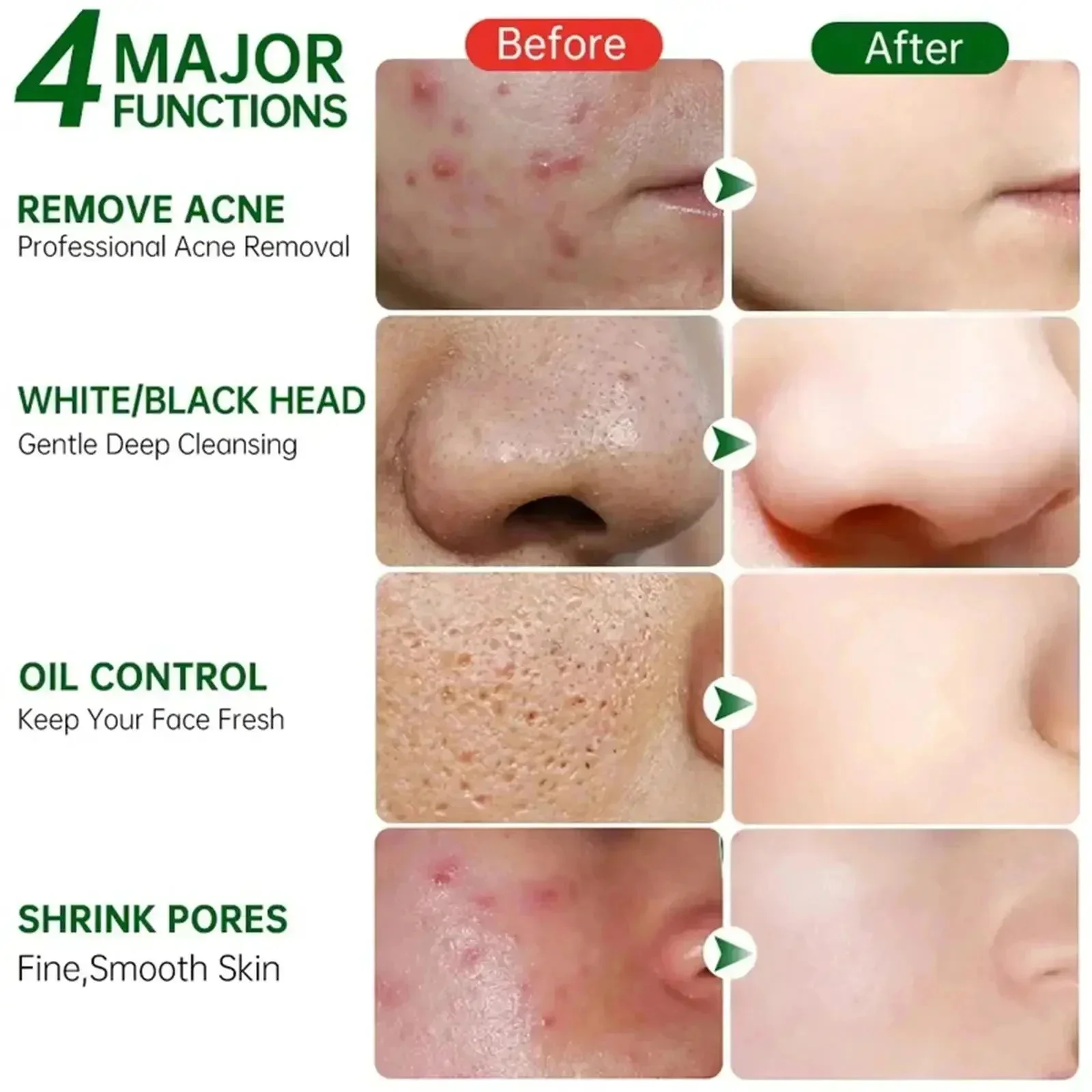 살리실산 모공 클리어링 크림 모공 축소 블랙헤드 제거  - Korean Skincare Routine 리뷰 및 가격